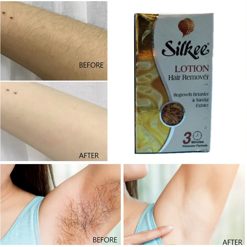 Лосьон для удаления волос SILK – обзор и цена Body Lotion
